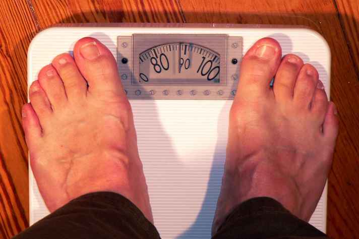 A coleta de dados envolveu 149 pacientes com obesidade grave