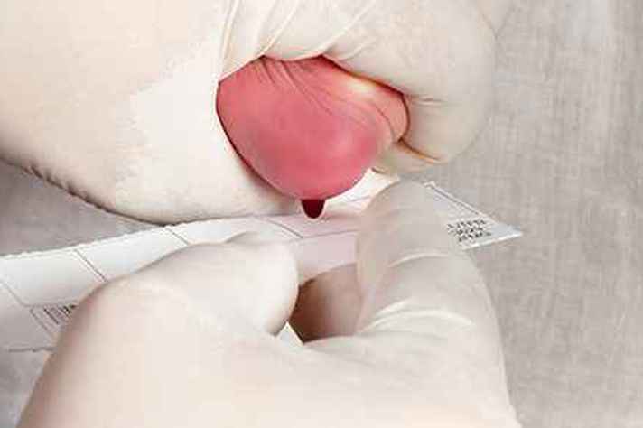 Teste do Pezinho é usado para diagnosticar a anemia falciforme