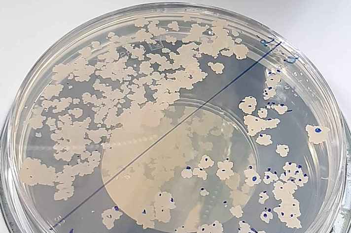 A bactéria 'Mycobacterium bovis', presente na vacina BCG