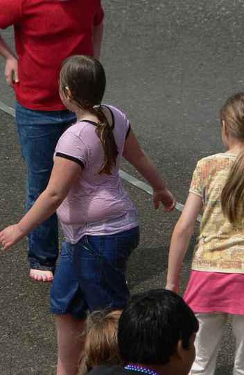 Ambientes inseguros concorrem para a obesidade infantil