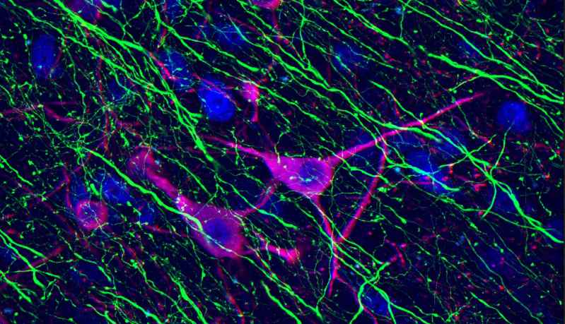 Axônios de neurônios corticais estimulados (em verde) projetam para a área negra e ativam alguns neurônios dopaminérgicos (em magenta); os demais permanecem inalterados (azul)