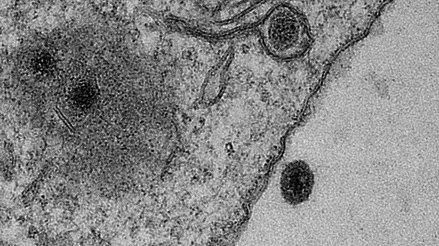 Na imagem, Yaravírus infecta uma ameba