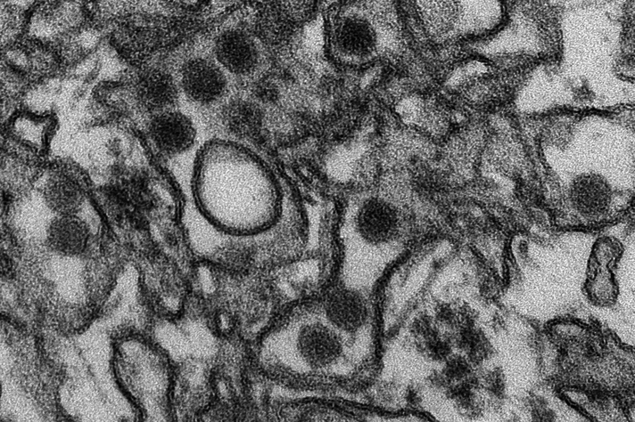 Micrografia eletrônica do zika vírus
