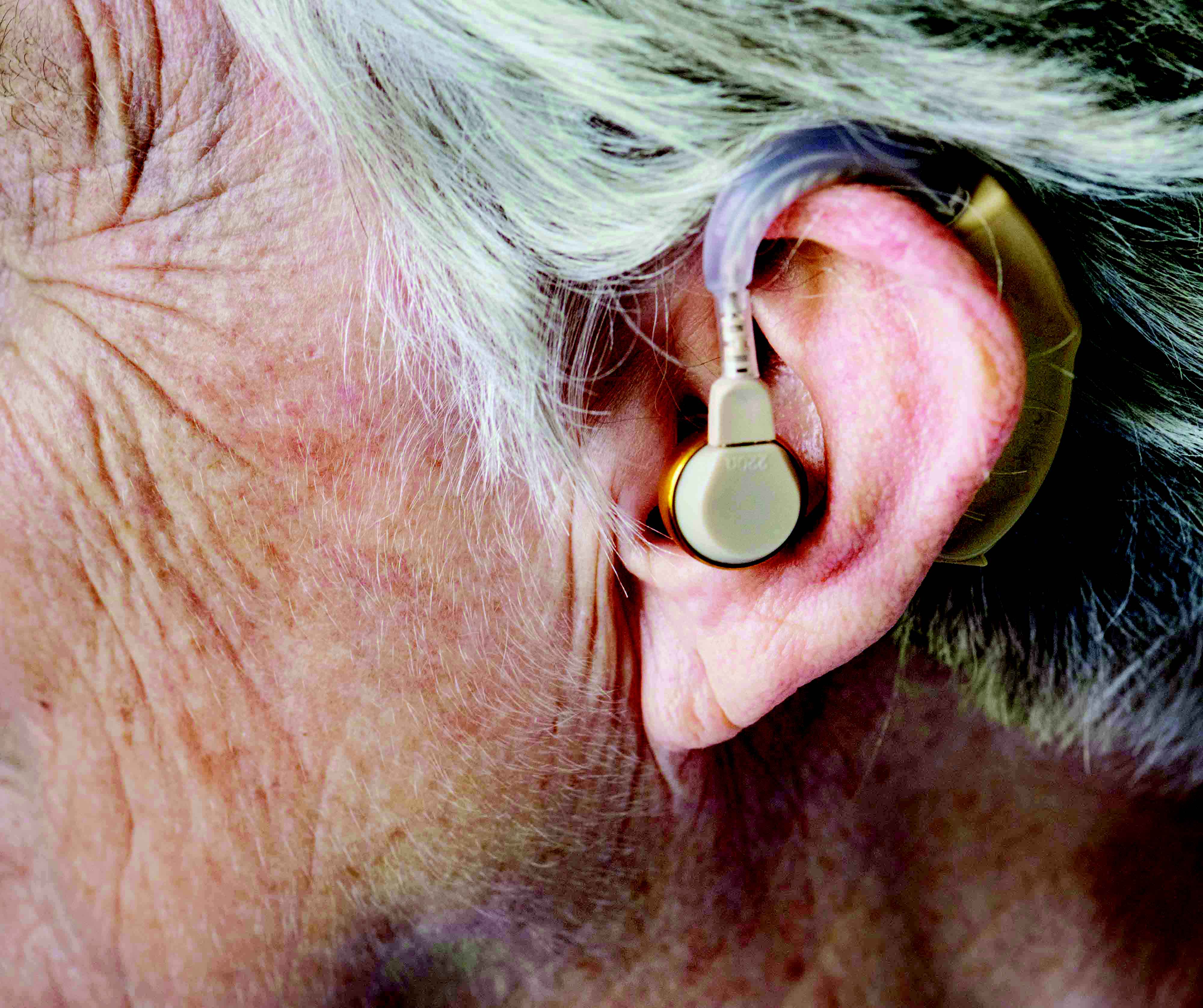 Para o tratamento, é preciso que o idoso reconheça sua perda auditiva
