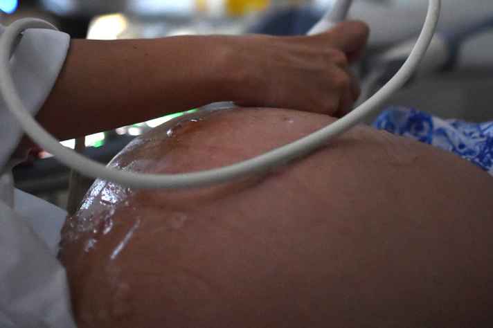 OMS divulga novos procedimentos para grávidas