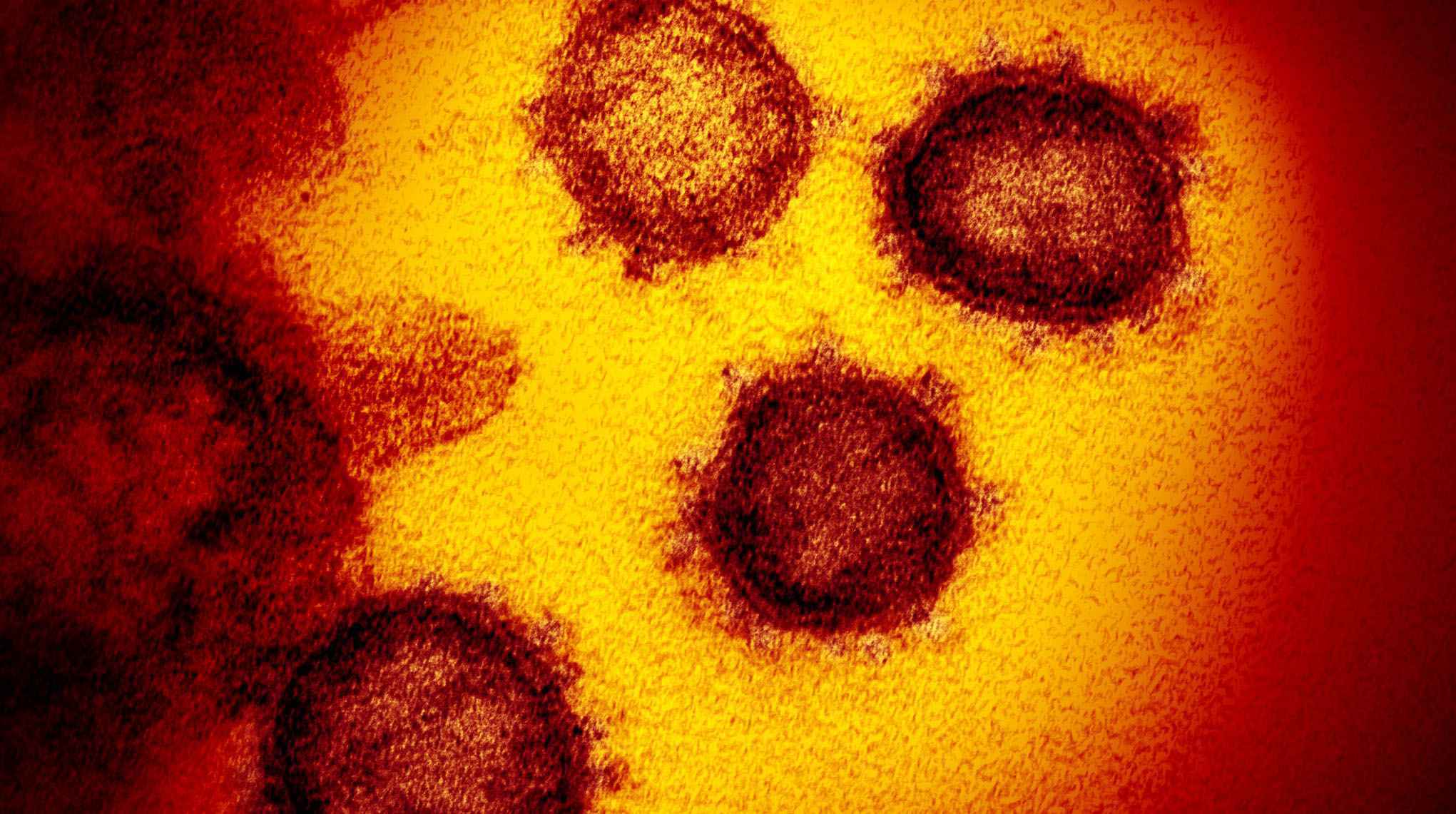SARS-CoV-2 isolado de um paciente nos EUA. Na imagem gerada por microscópio eletrônico de transmissão, as partículas do vírus emergem da superfície das células cultivadas em laboratório
