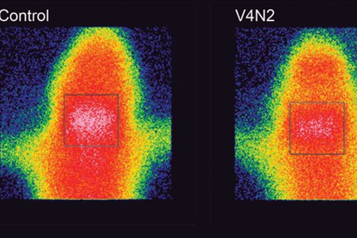 Exames de cintilografia comparam moléculas de cocaína marcadas radiotivamente que chegam ao cérebro de ratos vacinados (à direita) e de grupo controle (à esquerda)
