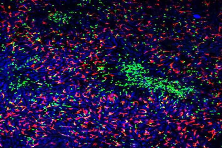 Células do sistema imunológico coradas em animais vivos. Em verde, os neutrófilos acumulam-se na região da lesão; em vermelho, macrófagos; em azul, a autofluorescência do parênquima hepático (estrutura física geral).