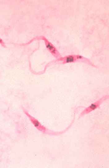 Imagem microscópica do Trypanosoma cruzi, o agente infeccioso da Doença de Chagas