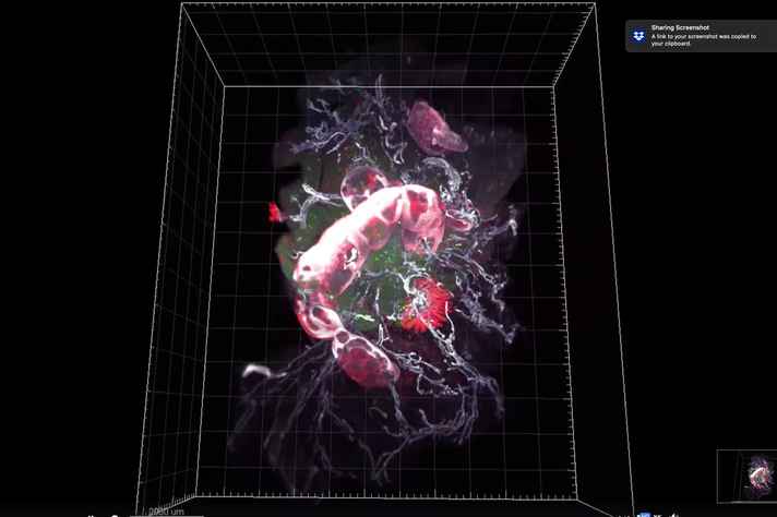 Imagem 3D da cadeia de linfonodos gerada pela técnica iDISCO mostra os diferentes gânglios da cadeia mesentérica (em vermelho) e os vasos linfáticos (em branco) que drenam as distintas regiões do intestino