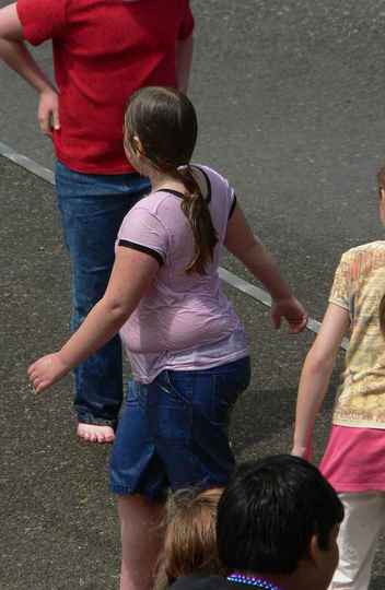 Pesquisa vai testar nova abordagem para o tratamento da obesidade infantil