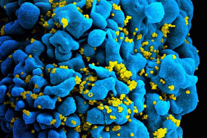 HIV, o vírus da Aids, infectando célula