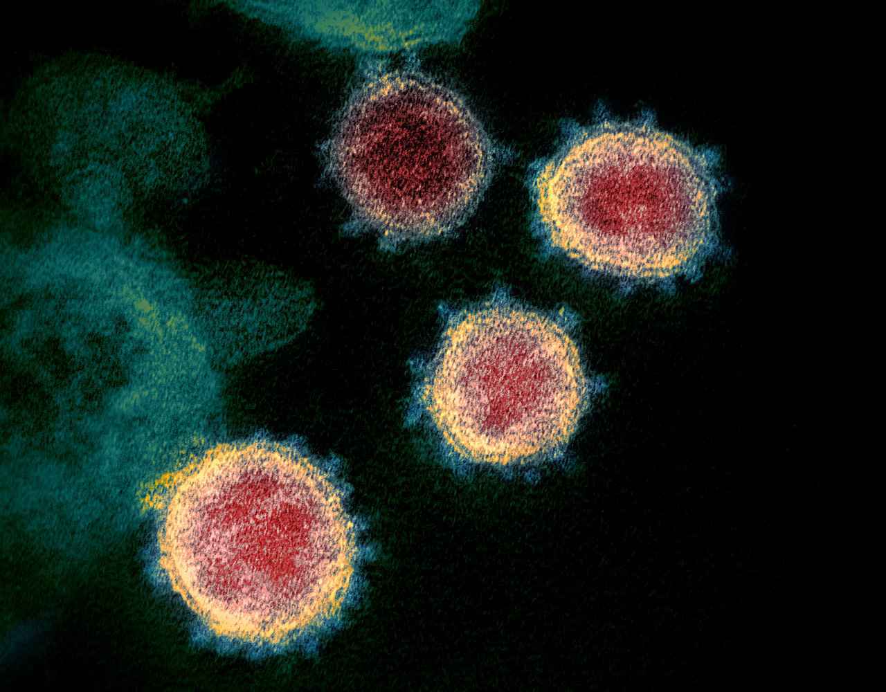 Imagem do Sars-CoV-2, o novo coronavírus, obtida por microscópio eletrônico de varredura