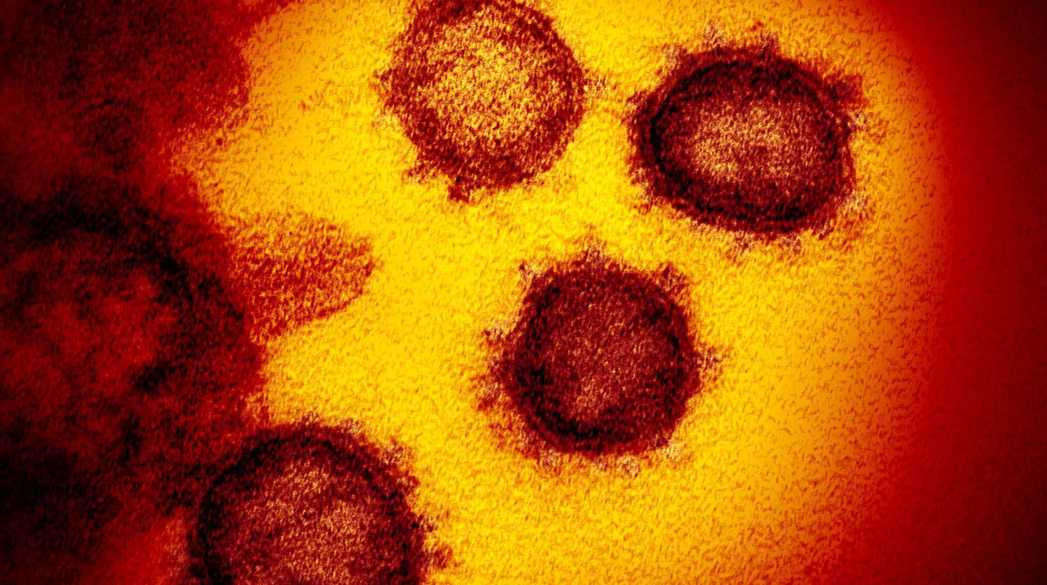 Sars-CoV-2 isolado de um paciente nos EUA; na imagem gerada por microscópio eletrônico de transmissão, as partículas do vírus emergem da superfície das células cultivadas em laboratório