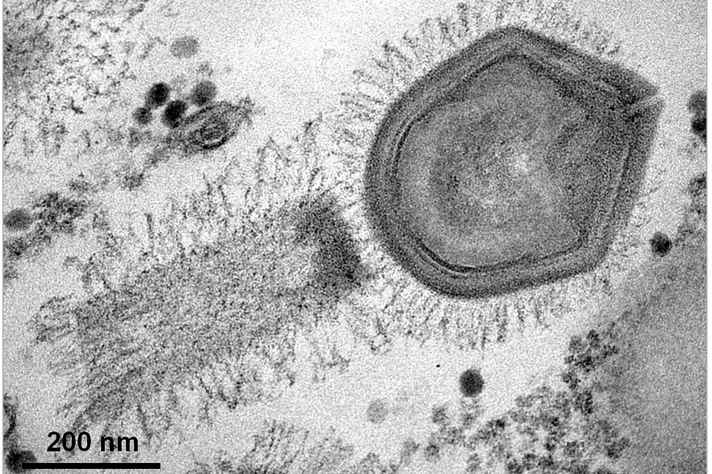 Imagem do tupanvírus, um dos vírus gigantes pesquisados