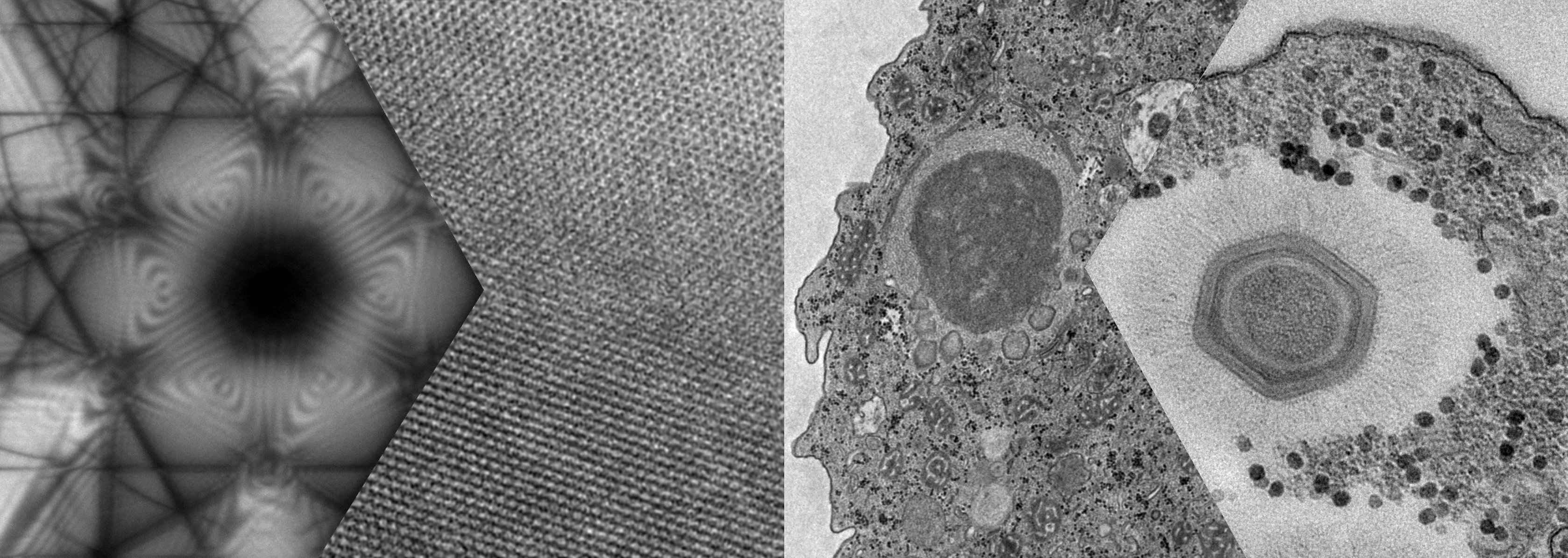 Imagens obtidas com o microscópio eletrônico de transmissão FEI Tecnai G2-20 SuperTwin (200kV)