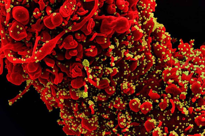 Célula infectada pelo Sars-CoV-2: pesquisadores esperam estabelecer plataforma