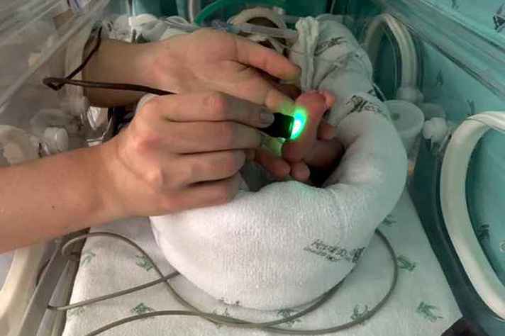 O Premiee-Test, dispositivo ótico com processamento digital, apresenta elevada acurácia em separar pré-maturos de bebês a termo