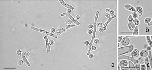 Imagens microscópicas da cepa 'Saccharomycopsis praedatoria UFMG-CM-Y6632'