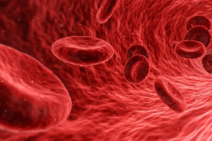 Hemofilia A é caracterizada por problemas na coagulação do sangue