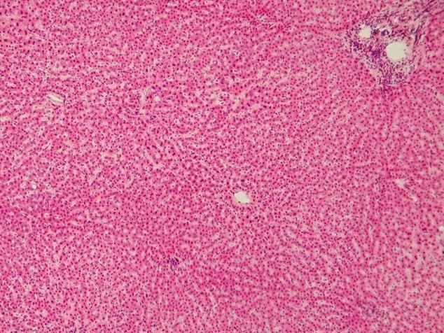 Detalhe de um fígado humano mostrando os hepatócitos