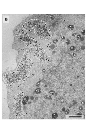 Imagem do Yaravírus: proteínas nunca antes vistas