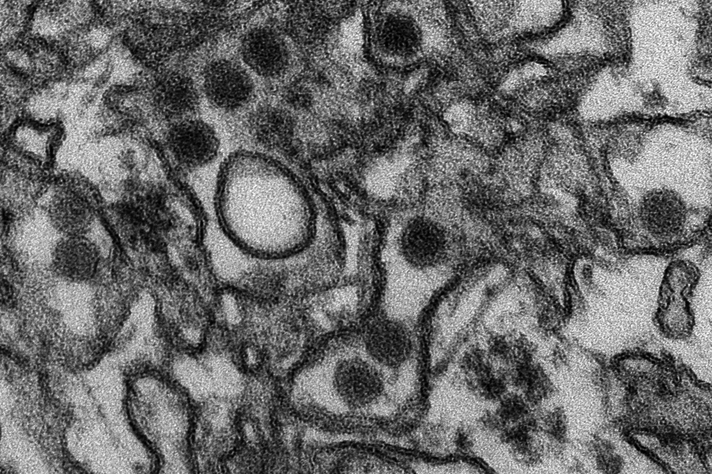 Micrografia eletrônica do zika vírus