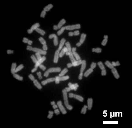 Cromossoma humano em processo de metáfase