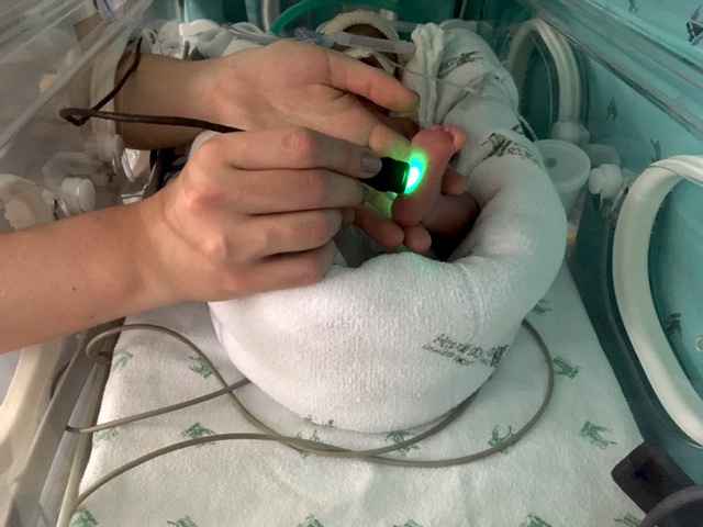 Teste com bebê prematuro com Luz de LED