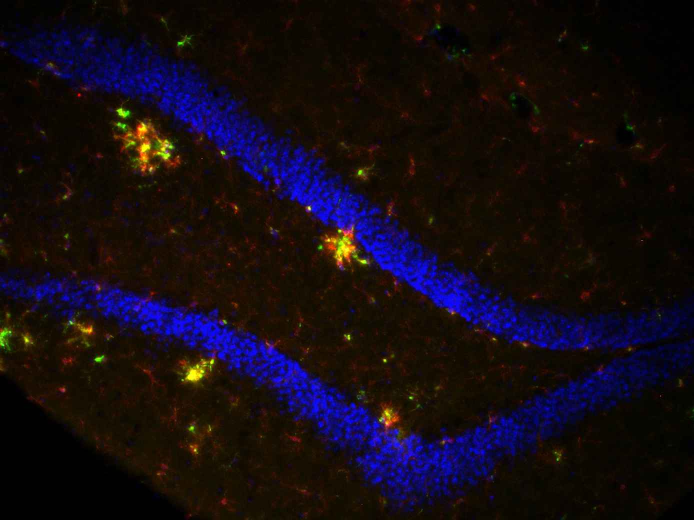 Imagem do hipocampo (região do sistema nervoso central) de um camundongo, modelo usado para pesquisas sobre a Doença de Alzheimer