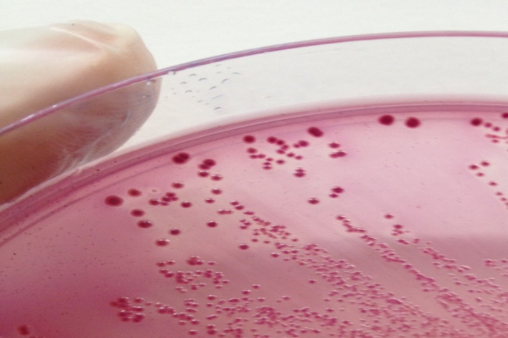 Escherichia coli, bactéria responsável por mais de 90% dos casos de piometra
