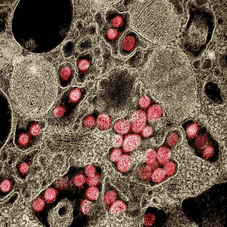 Imagem obtida por microscópio eletrônico de transmissão (MET) de partículas de Sars-CoV-2 (em vermelho) isoladas de um paciente