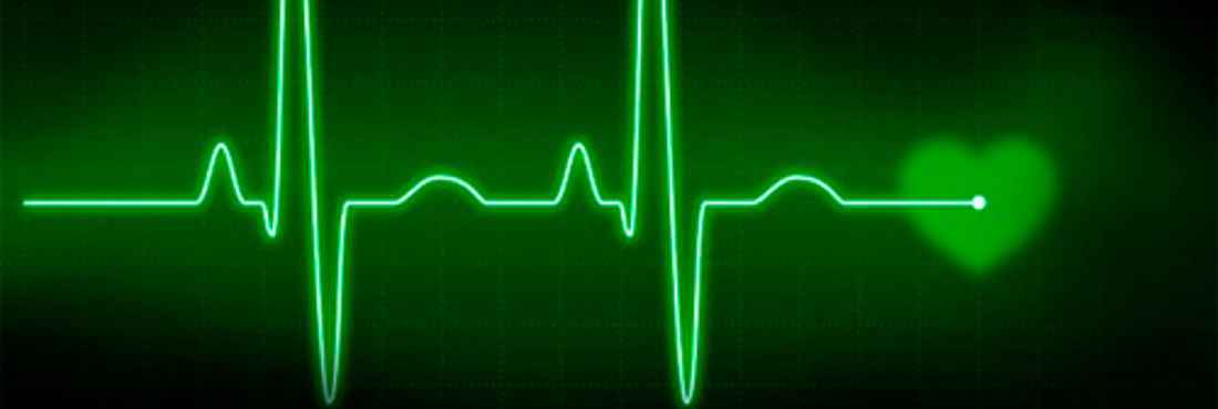 Imagem de um eletrocardiograma: