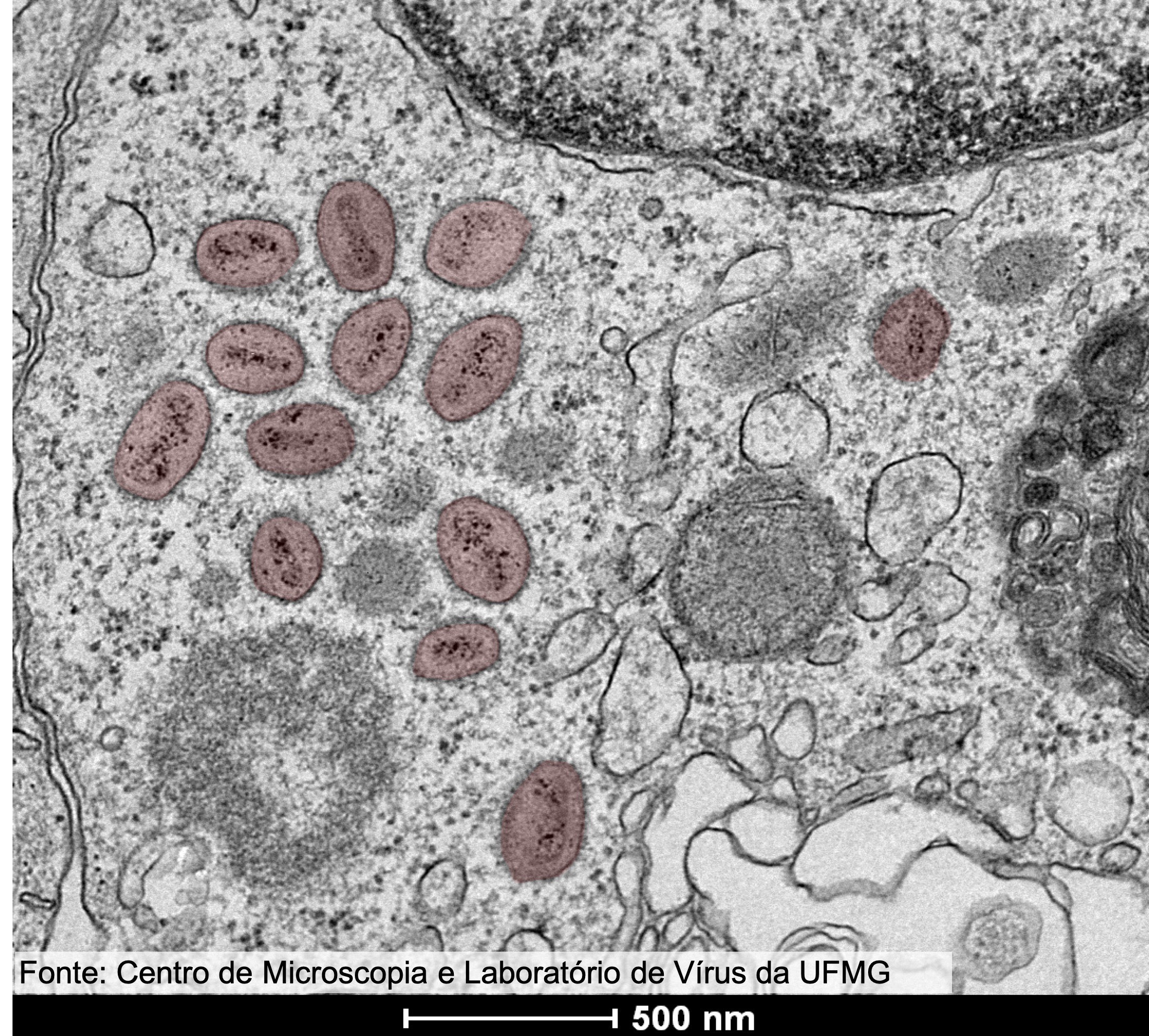 Imagem de amostra do vírus monkeypox obtida por microscopia eletrônica